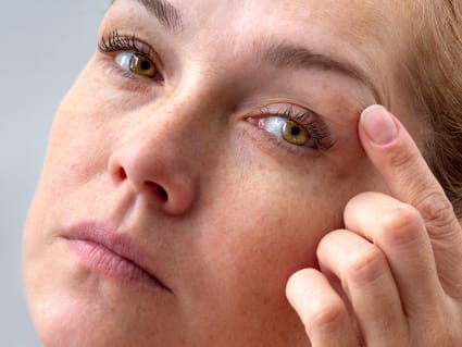 Blepharoplasty blog